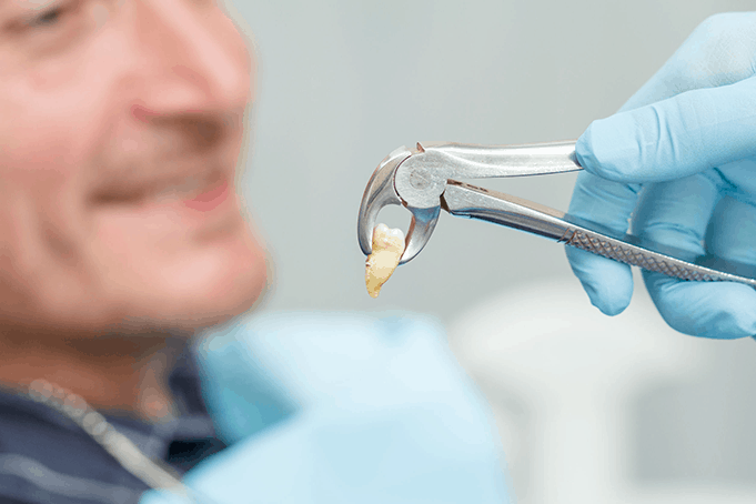Extractions